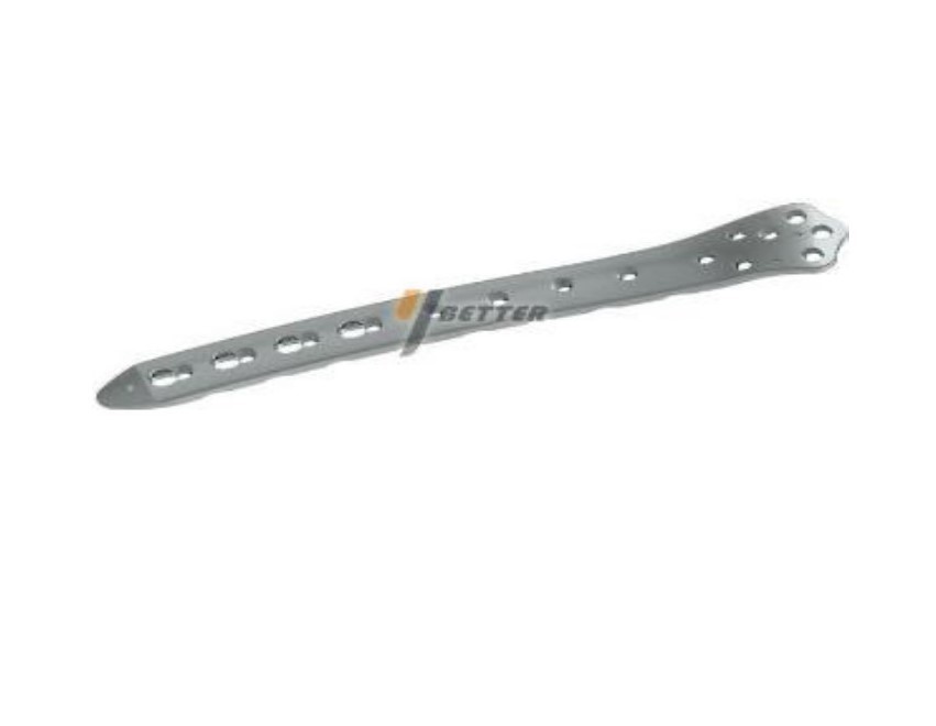 locking plate system