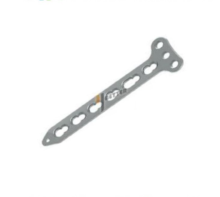 locking plate system