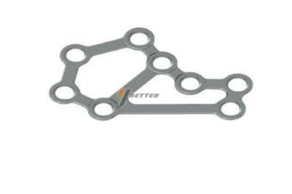 locking plate system