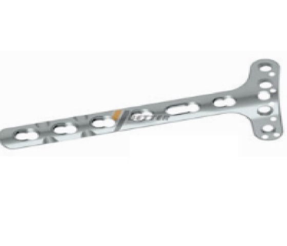 locking plate system
